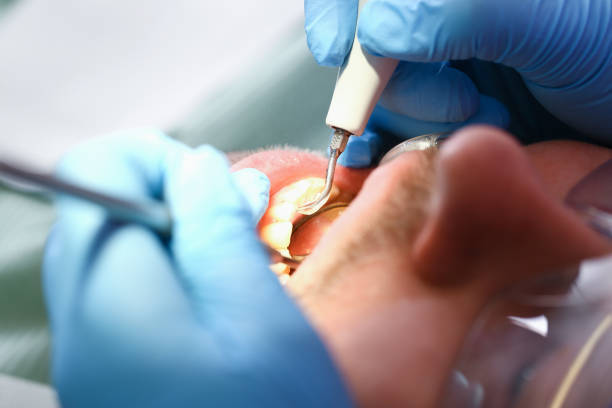 Best Pediatric Emergency Dentist in Saxapahaw, NC